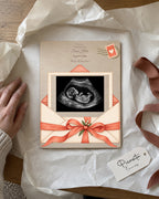 Simulated preview: Letter from baby on Plywood, 15 × 20 cm, with an illustrative synthetic ultrasound. Gift scene.