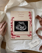 Simulated preview: First photo on Plywood, 15 × 20 cm, with an illustrative synthetic ultrasound. Gift scene.