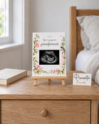 Simulated preview: Botanical on Canvas, 15 × 20 cm, with an illustrative synthetic ultrasound. Scene with a 20 cm easel on a table.